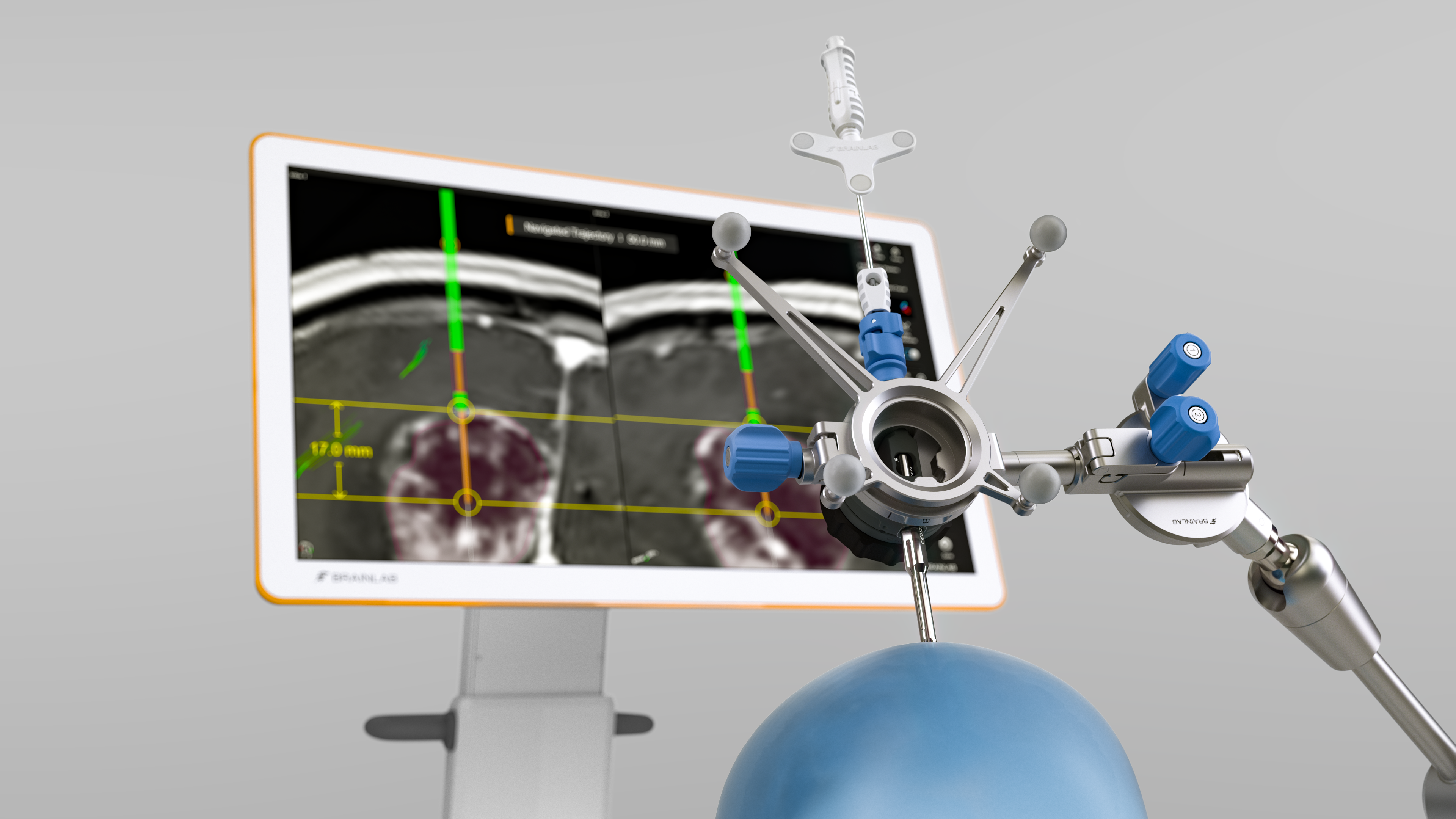 Cranial Navigation: Advanced Neuronavigation | Brainlab